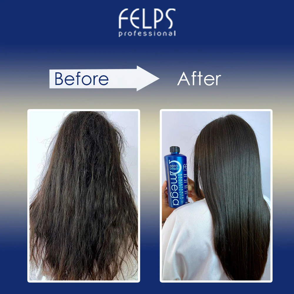 Felps Thermal Sealing Omega Zero Nanoplastia & XBTX Okra Smoothing Mask Duo - Image 2