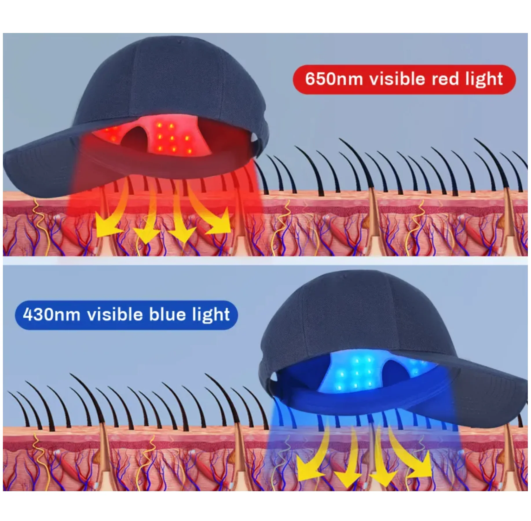 Red and Blue Light Therapy Hair Growth Head Cap - Image 3