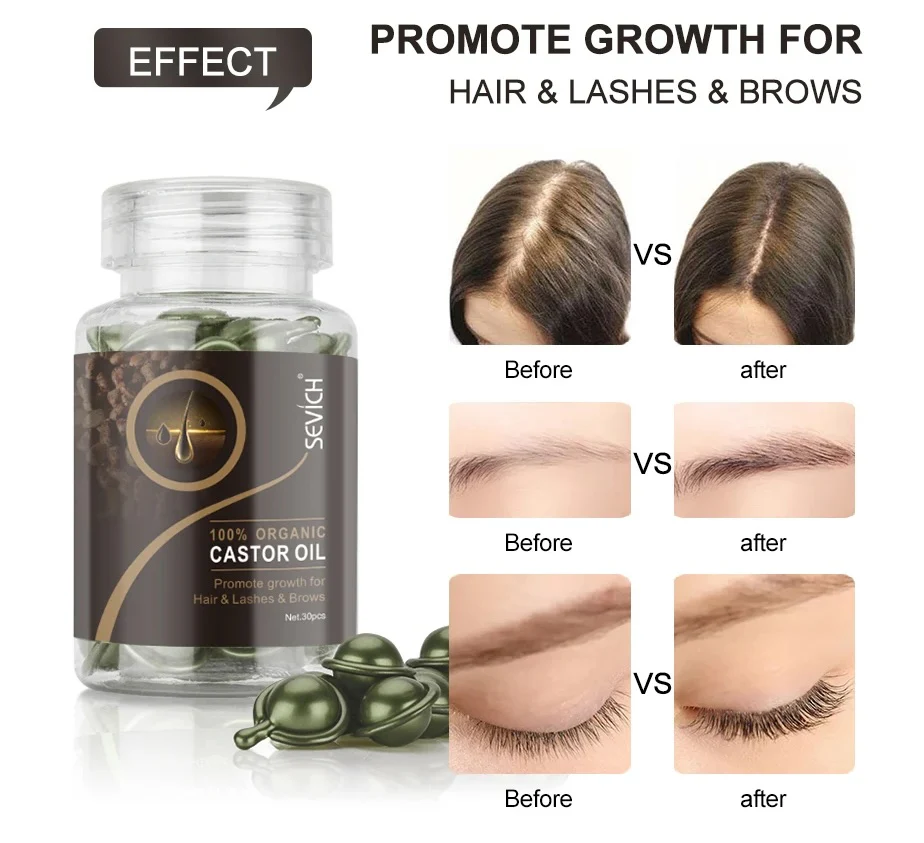 Sevich 100% Organic Castor Oil Hair Growth Capsule 30pcs - Image 2